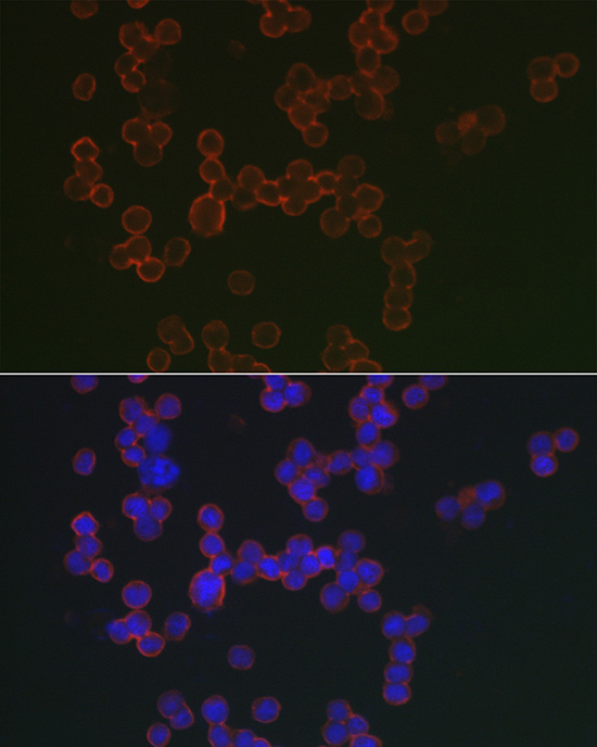 CD20 Rabbit polyclonal antibody