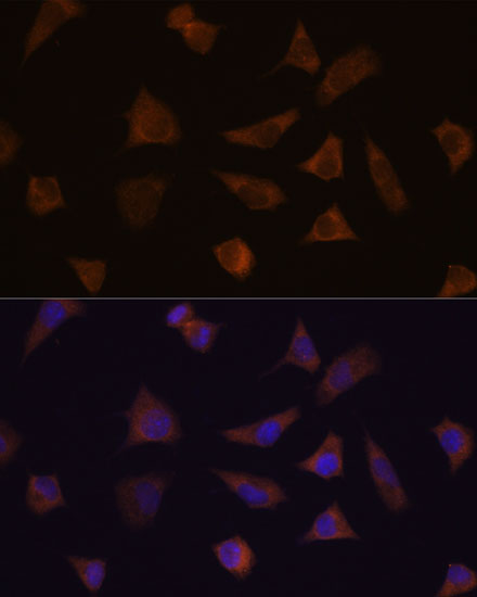 ENAH Rabbit polyclonal antibody
