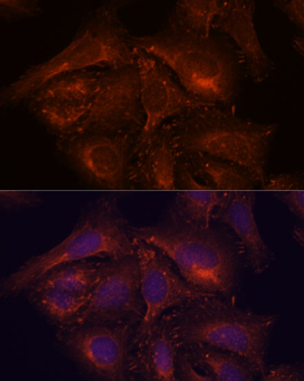 ENAH Rabbit polyclonal antibody