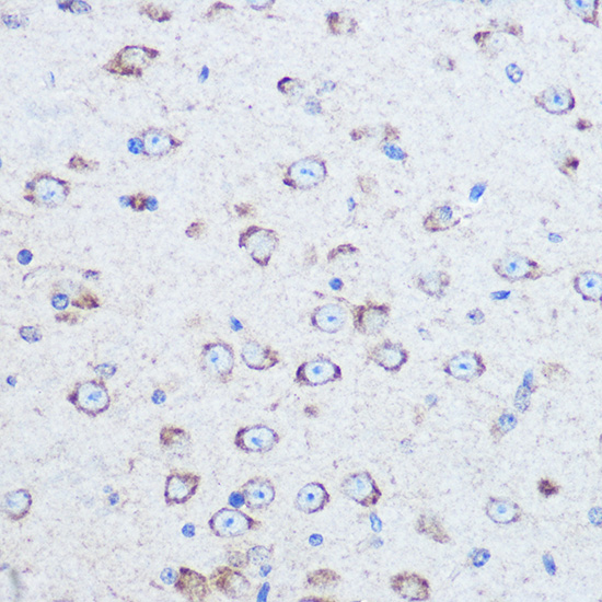 RELN Rabbit polyclonal antibody
