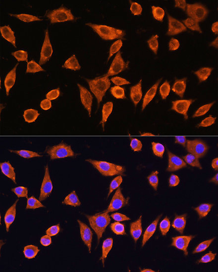 RPS28 Rabbit polyclonal antibody