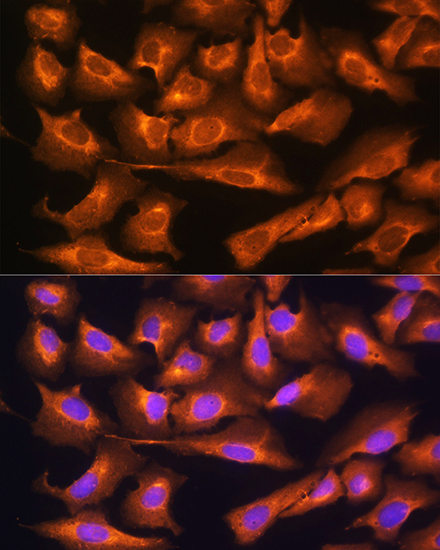 RPS28 Rabbit polyclonal antibody