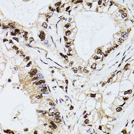 DCK Rabbit polyclonal antibody