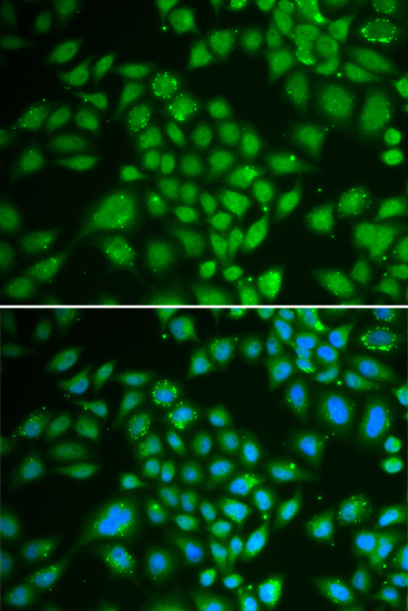 DCK Rabbit polyclonal antibody