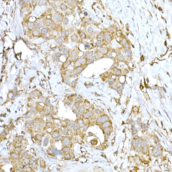 IRE1 Rabbit polyclonal antibody