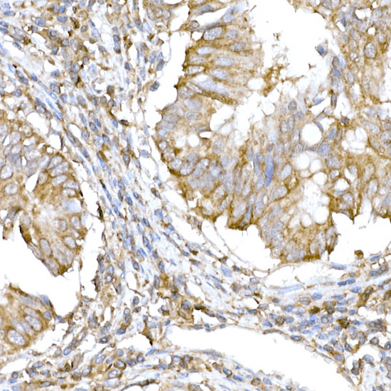 IRE1 Rabbit polyclonal antibody