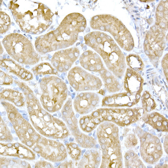IRE1 Rabbit polyclonal antibody