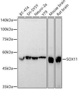 SOX11 Rabbit polyclonal antibody