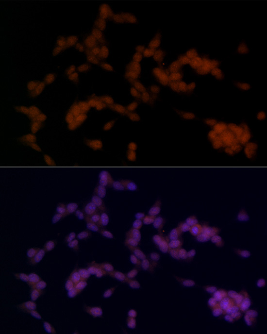 SOX11 Rabbit polyclonal antibody