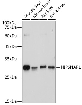 NIPSNAP1 Rabbit polyclonal antibody
