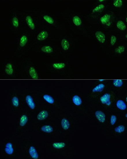 DHX9/RNA Helicase A Rabbit polyclonal antibody