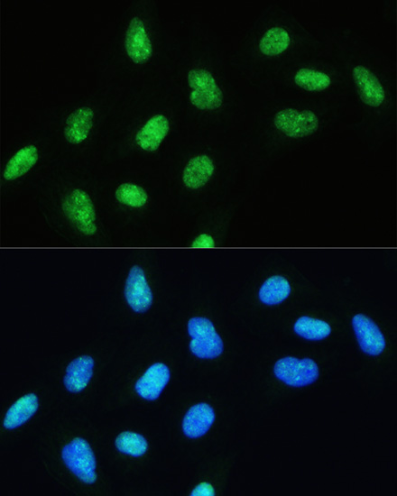 DHX9/RNA Helicase A Rabbit polyclonal antibody