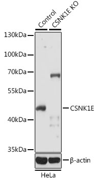 [KO Validated] CSNK1E Rabbit polyclonal antibody