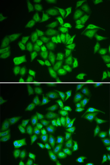 [KO Validated] CSNK1E Rabbit polyclonal antibody