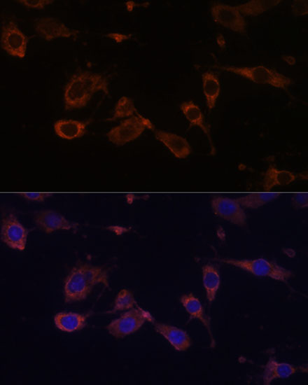 MT-ATP6 Rabbit polyclonal antibody