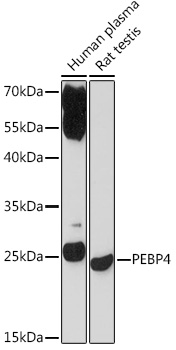 PEBP4 Rabbit polyclonal antibody