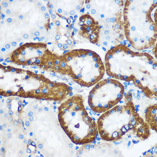PEBP4 Rabbit polyclonal antibody