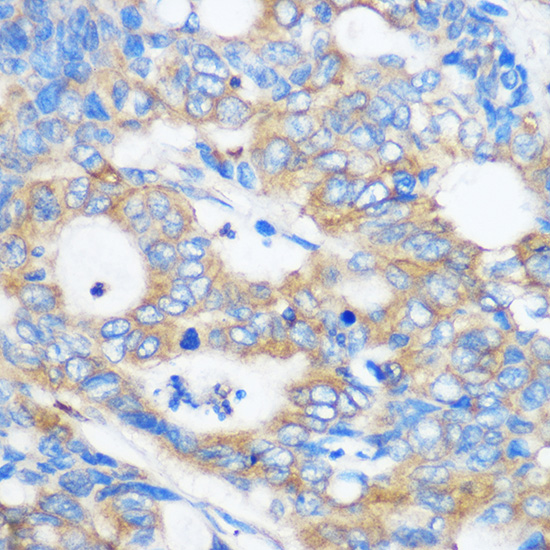 PEBP4 Rabbit polyclonal antibody