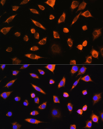 PEBP4 Rabbit polyclonal antibody