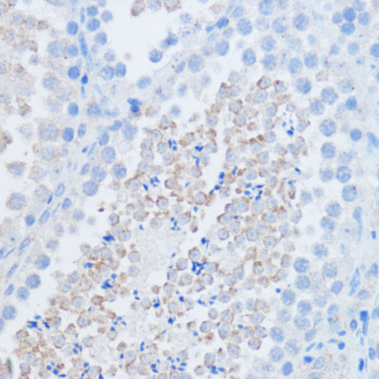 RALGDS Rabbit polyclonal antibody