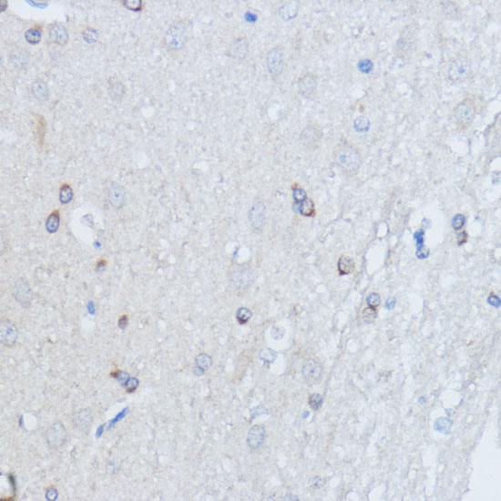 RALGDS Rabbit polyclonal antibody