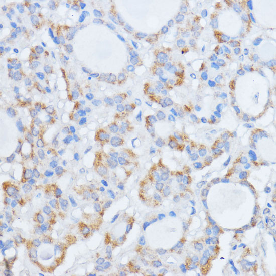 RALGDS Rabbit polyclonal antibody