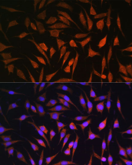RALGDS Rabbit polyclonal antibody