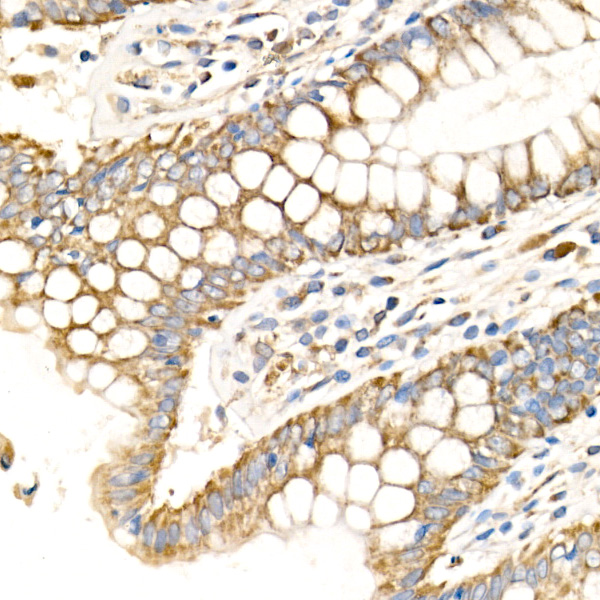 MTCO2 Rabbit polyclonal antibody