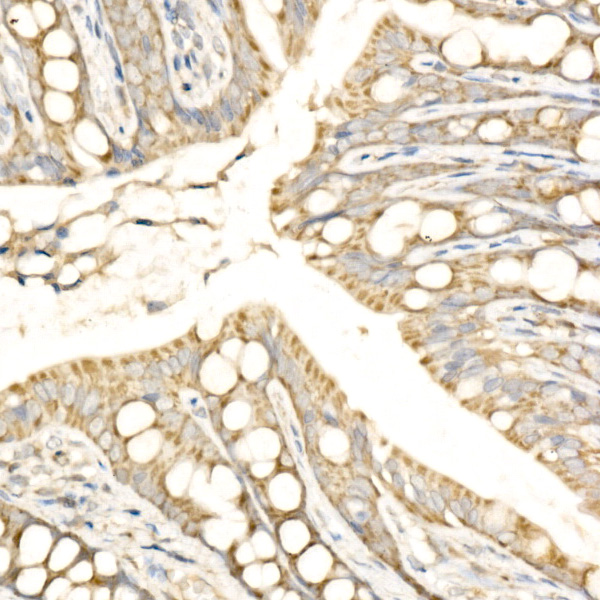 MTCO2 Rabbit polyclonal antibody