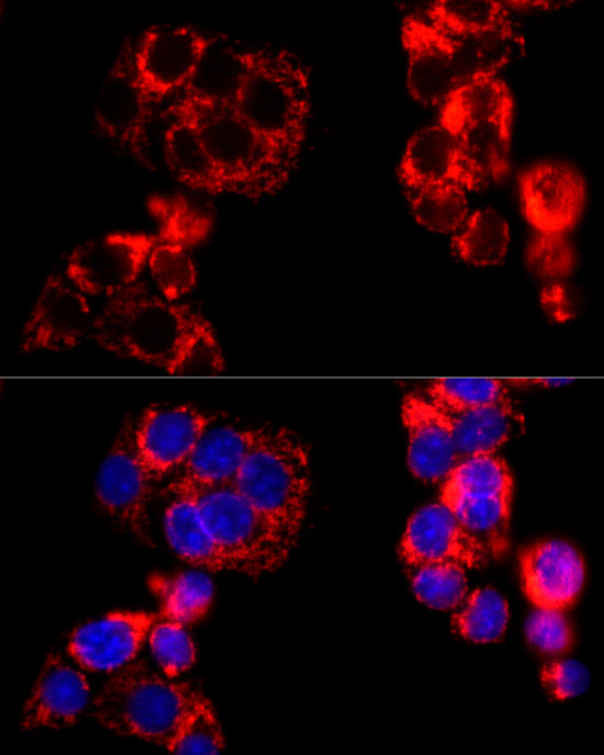 MTCO2 Rabbit polyclonal antibody