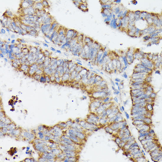 MT-CYB Rabbit polyclonal antibody