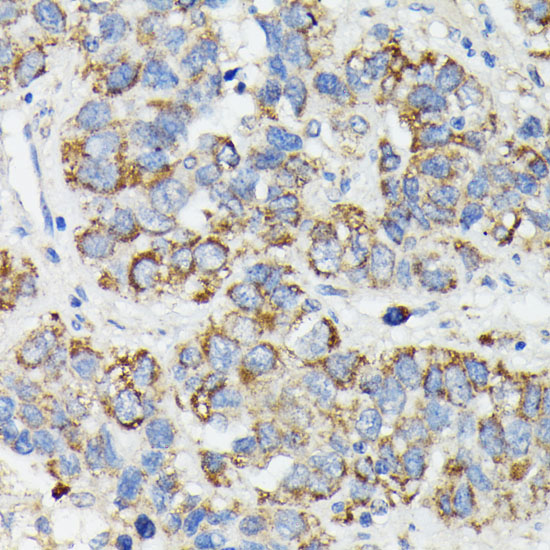 MT-CYB Rabbit polyclonal antibody