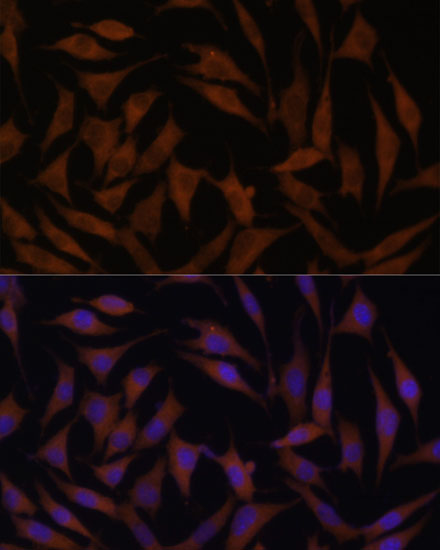 MT-CYB Rabbit polyclonal antibody