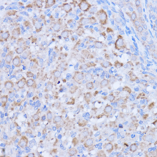MT-ND1 Rabbit polyclonal antibody