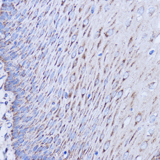 MT-ND1 Rabbit polyclonal antibody