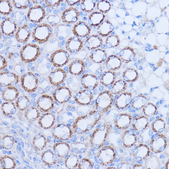 MT-ND1 Rabbit polyclonal antibody