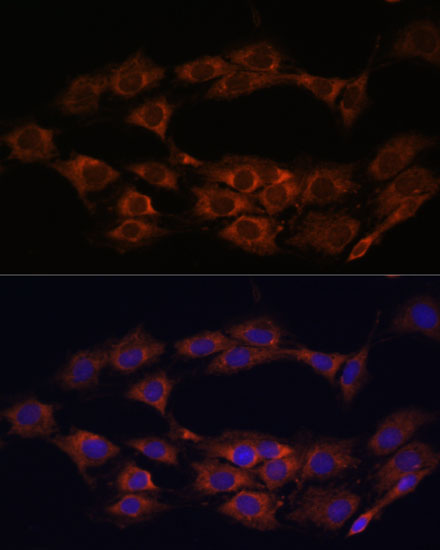 MT-ND1 Rabbit polyclonal antibody