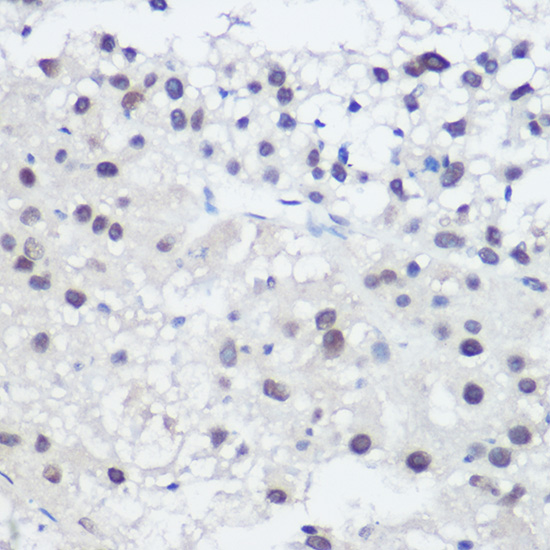 GADD45A Rabbit polyclonal antibody