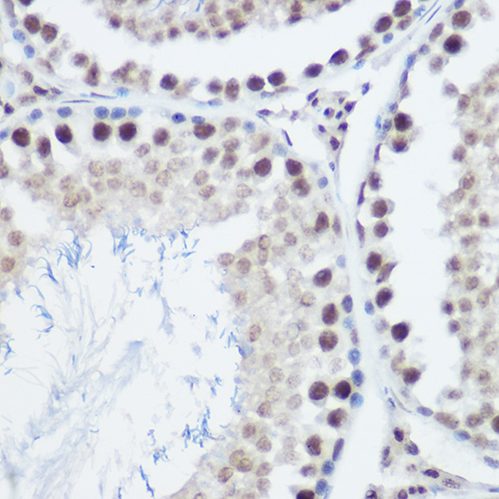 GADD45A Rabbit polyclonal antibody