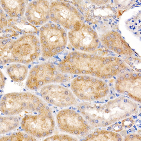 MT-ND4 Rabbit polyclonal antibody