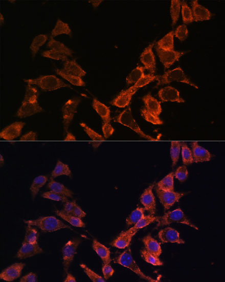 MT-ND4 Rabbit polyclonal antibody