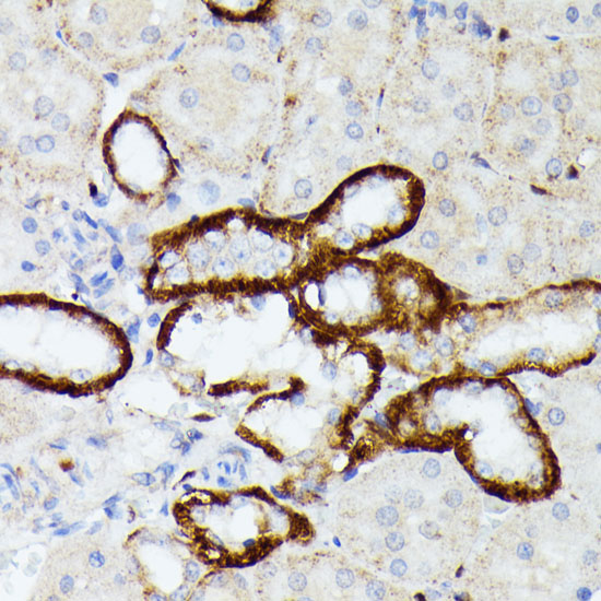 MT-ND5 Rabbit polyclonal antibody
