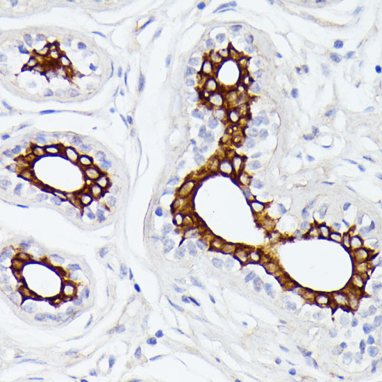 MT-ND5 Rabbit polyclonal antibody