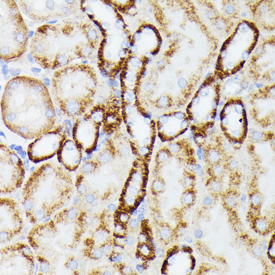 MT-ND5 Rabbit polyclonal antibody