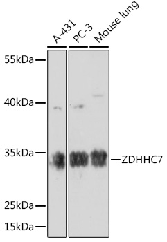 ZDHHC7 Rabbit polyclonal antibody