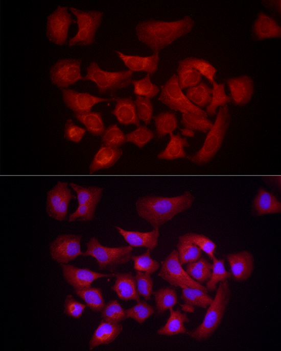 DUSP8 Rabbit polyclonal antibody