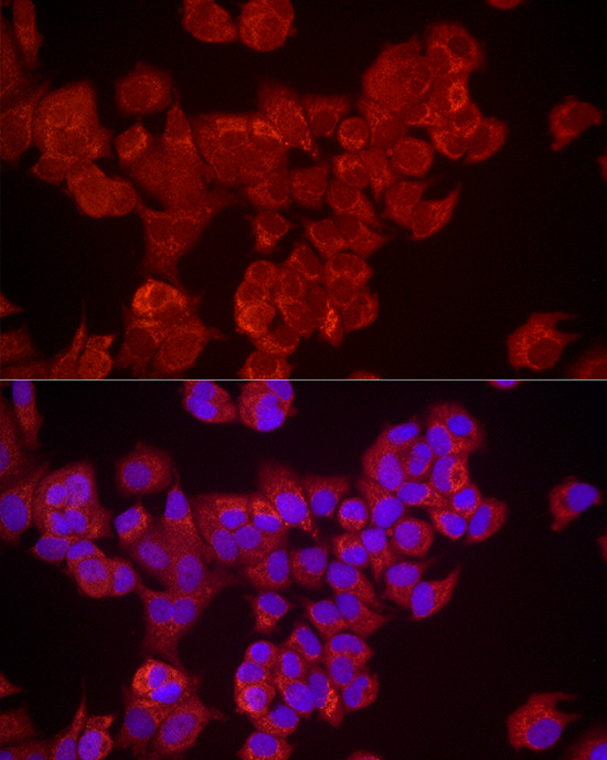 DUSP8 Rabbit polyclonal antibody