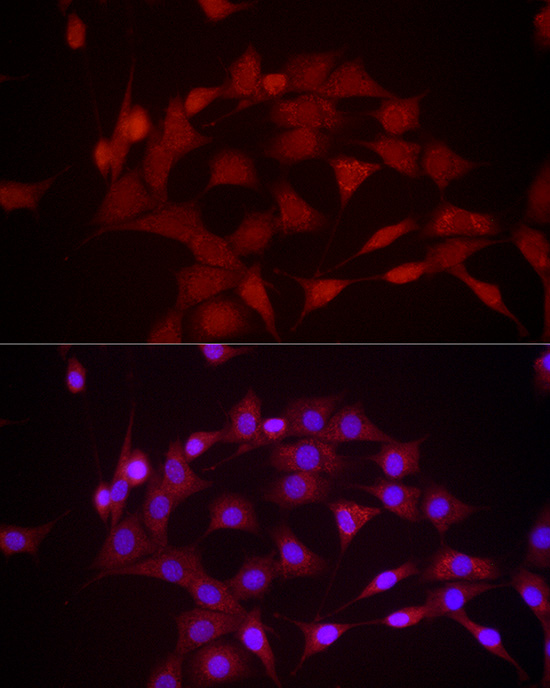 DUSP8 Rabbit polyclonal antibody