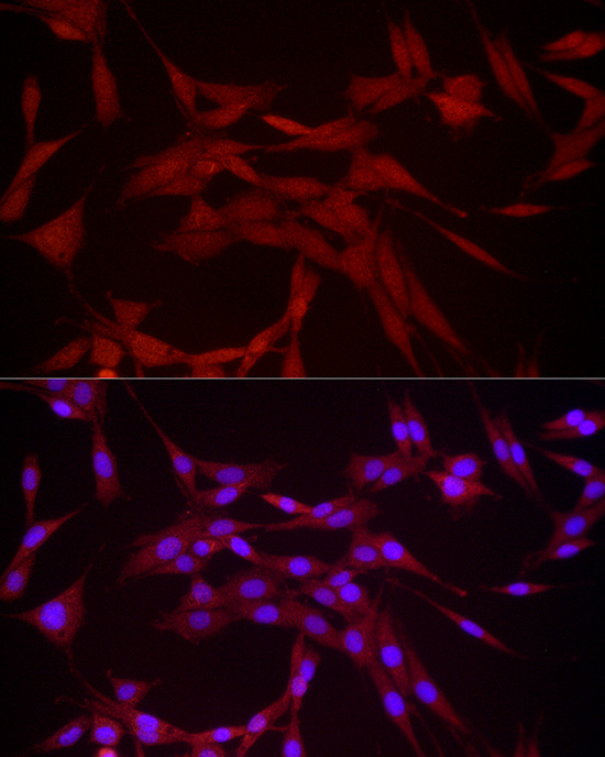 DUSP8 Rabbit polyclonal antibody