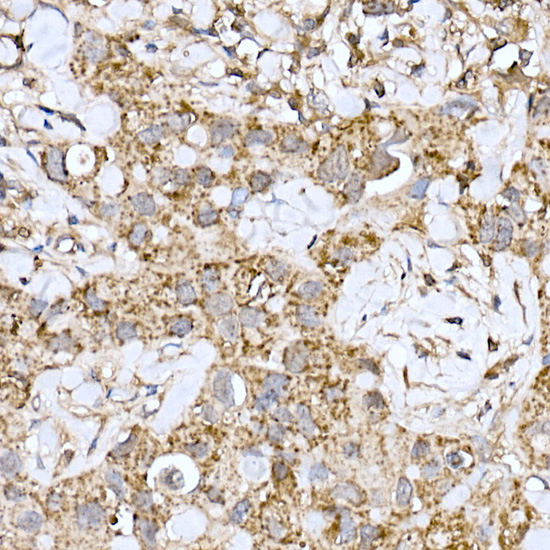 MT-ND6 Rabbit polyclonal antibody